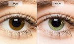Charger l'image dans la galerie, 1+1 Kostenlos | IriGlow™ Farbwechselnde Augentropfen für einen einzigartigen Look

