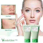 Charger l'image dans la galerie, 1+1 GRATIS | VerdeGlow™ Grünes Tomaten Tonerde Maske – Tiefenreinigung und Anti-Akne
