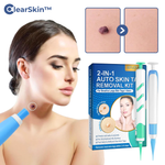 Charger l'image dans la galerie, ClearSkin™ Warzenentferner Stift

