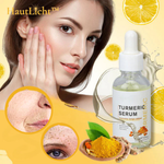 Charger l'image dans la galerie, HautLicht™ Kurkuma Serum gegen dunkle Flecken
