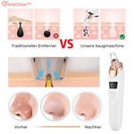 Charger l'image dans la galerie, PoreGlow™ Mitesser Entferner Set
