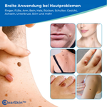 Charger l'image dans la galerie, ClearSkin™ Warzenentferner Stift
