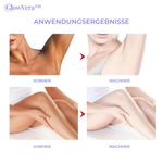 Charger l'image dans la galerie, GlowVera™ Aufhellende Körpercreme
