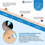 Charger l'image dans la galerie, ClearSkin™ Warzenentferner Stift
