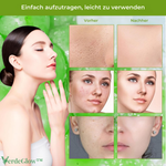Charger l'image dans la galerie, 1+1 GRATIS | VerdeGlow™ Grünes Tomaten Tonerde Maske – Tiefenreinigung und Anti-Akne
