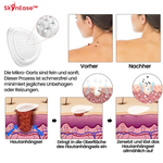 Charger l'image dans la galerie, SkinEase™ Microdarts Anti-Falten Patch
