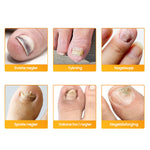 Charger l'image dans la galerie, 1+1 Gratis | Nalix™ - Wirksame Behandlung von Nagelpilz

