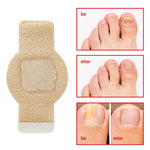 Charger l'image dans la galerie, 1+1 Gratis | Nalix™ - Wirksame Behandlung von Nagelpilz
