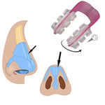 Charger l'image dans la galerie, NoseLift™ – Clip Rehausseur de Nez Sans Chirurgie
