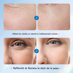 Charger l'image dans la galerie, ✨ ViyaClean™ – Sérum Nettoyant Anti-Pores; Retrouvez une peau plus nette, plus lisse et plus lumineuse dès votre routine quotidienne
