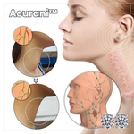 Charger l'image dans la galerie, 1+1 GRATIS | Acurani™️ Magnetische Therapie-Ohrringe

