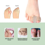 Charger l'image dans la galerie, Correcteur Confort+ Retrouvez enfin le confort de marcher sans douleur.
